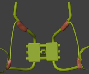 3D Model of Rapid Palatal Expander