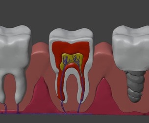 3D Dental Model - Teeth and Gum