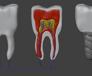 3D Model of Teeth - Dental Model