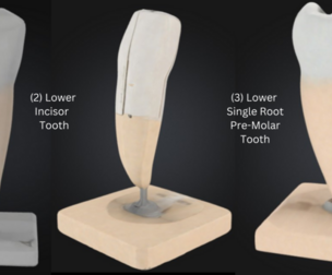 3D Tooth Models Bundle - 4 Pack