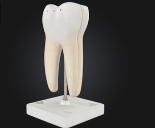 3D Model of Lower Twin Root Molar