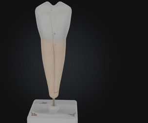 3D Model of Lower Canine Tooth