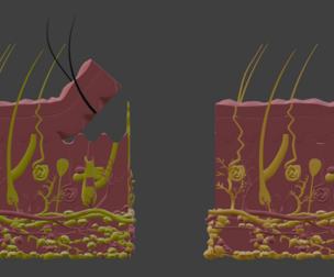 3D Model of Skin Anatomy