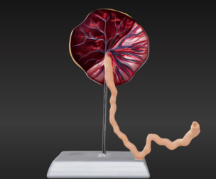 3D Placenta Model with Umbilical Cord