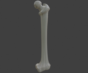 3D Femur Bone Model