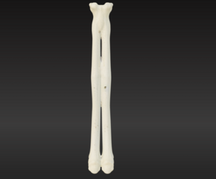 3D Model of Radius Bone
