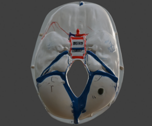 3D Model of Skull with Blood Vessels