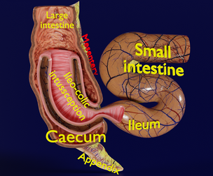 Intussusception intestine ileocolic obstruction