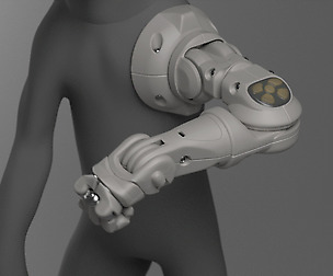 prosthetic arm
