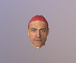 Mentor 3D Scan Head