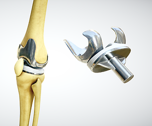 Knee Endoprosthesis