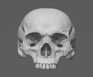 Skull Ring without Jaw
