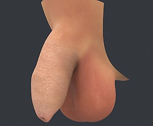 Uncircumcised Male Penis
