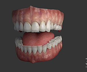 Gums Teeth and Tongue