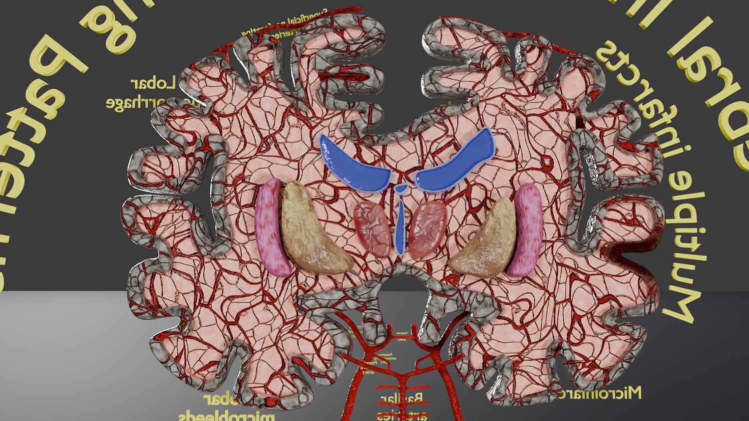 Stroke brain infarct hemorrhage types